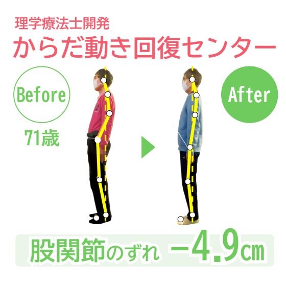 【ひざ・腰・股関節・姿勢が気になる方へ】姿勢と動きのくせチェック開催中！